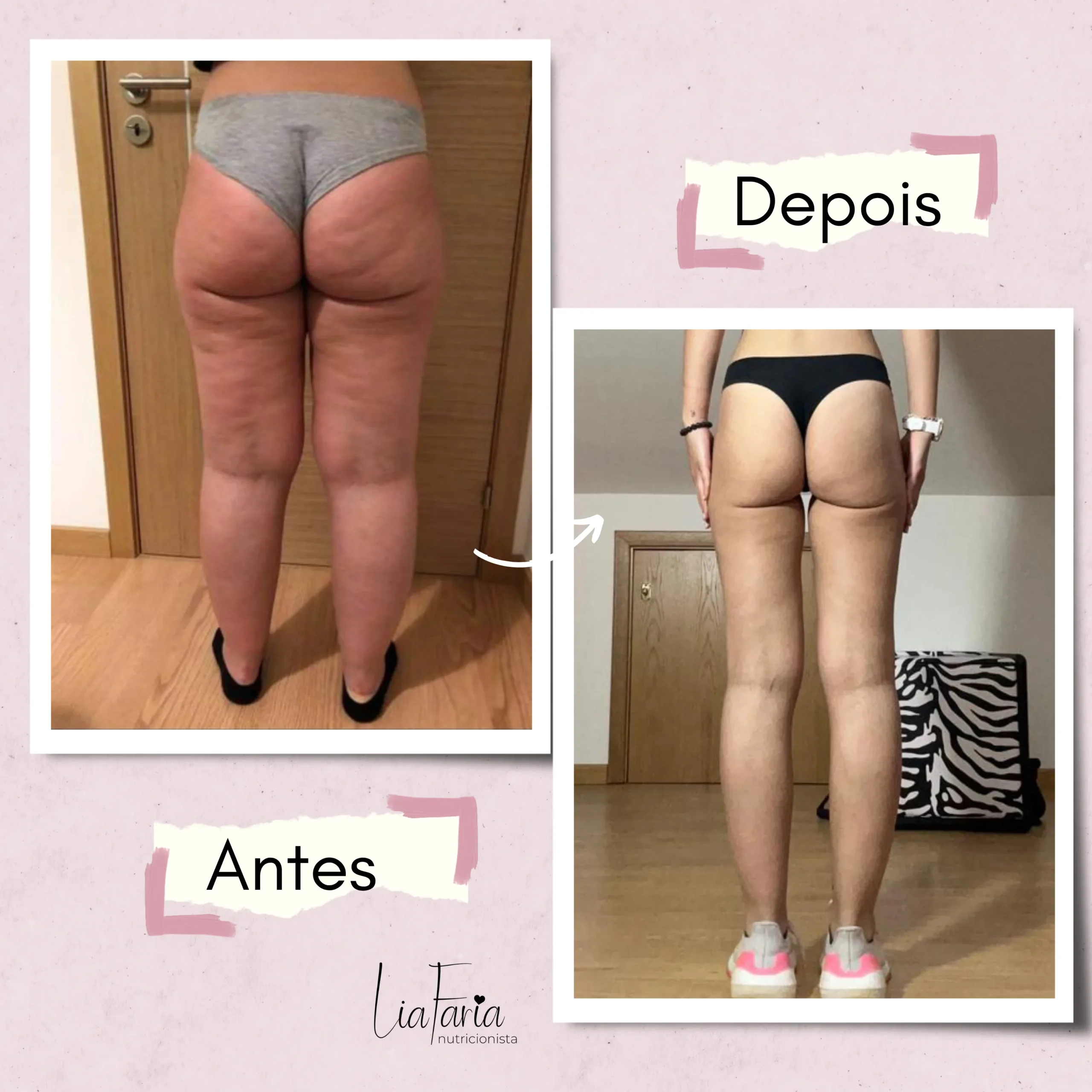 liafaria-antesdepois-13-scaled.webp